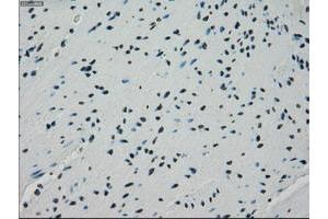 Image no. 5 for anti-Crystallin, alpha B (CRYAB) antibody (ABIN1497641) (CRYAB Antikörper)