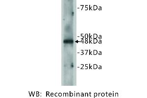 Image no. 2 for anti-Cadherin EGF LAG Seven Pass G-Type Receptor 2 (CELSR2) antibody (ABIN1112870) (CELSR2 Antikörper)