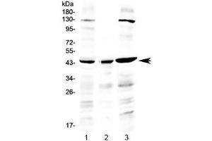 Western blot testing of human 1) HeLa, 2) placenta and 3) A549 lysate with PREB antibody at 0. (PREB Antikörper)