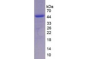 SDS-PAGE analysis of Chicken Interleukin 17 Protein. (IL-17 Protein)