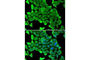 Immunofluorescence analysis of U2OS cells using MYH1 antibody.
