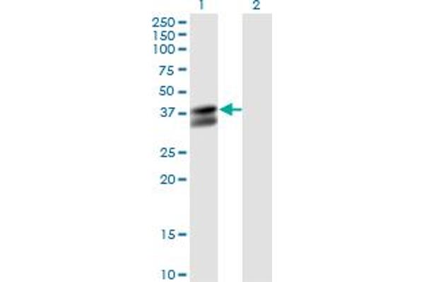 PDHB anticorps  (AA 250-359)