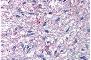Immunohistochemical (Formalin/PFA-fixed paraffin-embedded sections) staining in human pituitary with GPR50 polyclonal antibody . (GPR50 Antikörper  (C-Term))