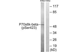 Western Blotting (WB) image for anti-Ribosomal Protein S6 Kinase, 70kDa, Polypeptide 2 (RPS6KB2) (pSer423) antibody (ABIN1847634) (RPS6KB2 Antikörper  (pSer423))