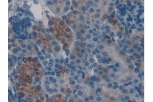 #VALUE! (Frataxin Antikörper  (AA 41-207))