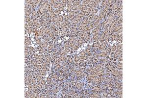 IHC analysis of TRMT61A using anti-TRMT61A antibody (ABIN7599220).