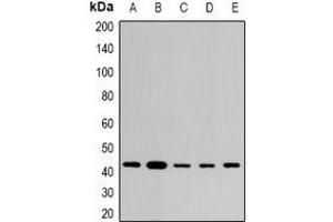 Western blot analysis of STX expression in THP1 (A), SKOV3 (B), mouse brain (C), mouse lung (D), rat heart (E) whole cell lysates. (ST8SIA2 Antikörper)