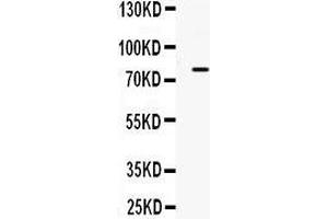 Observed bind size: 80KD (ADRBK2 Antikörper  (C-Term))