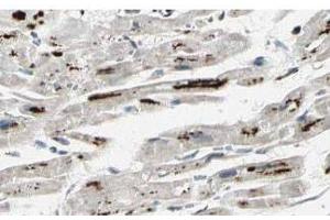 Affinity Purified anti-iASPP antibody shows strong cytoplasmic and membranous staining of myocytes in human heart tissue. (PPP1R13L Antikörper  (Isoform 1))