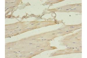 Immunohistochemistry of paraffin-embedded human skeletal muscle tissue using ABIN7161378 at dilution of 1:100 (Doublecortin Antikörper  (AA 108-360))