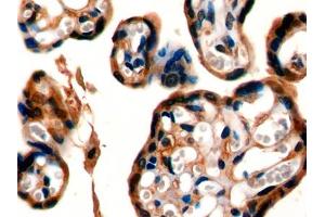 IHC-P analysis of Mouse Placenta Tissue, with DAB staining.
