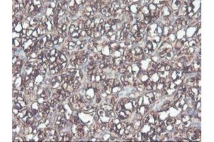 Image no. 9 for anti-CNDP Dipeptidase 2 (Metallopeptidase M20 Family) (CNDP2) antibody (ABIN1497548) (CNDP2 Antikörper)