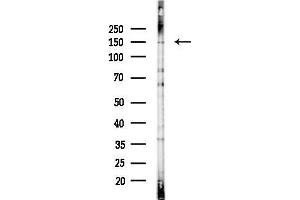 anti-Prune Homolog 2 (PRUNE2) (N-Term) antibody