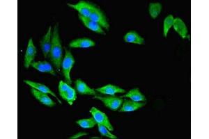 Immunofluorescent analysis of Hela cells using ABIN7146755 at dilution of 1:100 and Alexa Fluor 488-congugated AffiniPure Goat Anti-Rabbit IgG(H+L) (CMBL Antikörper  (AA 2-245))