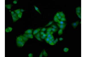 Immunofluorescence staining of PC-3 cells with ABIN7168748 at 1:166, counter-stained with DAPI. (PTTG2 Antikörper  (AA 1-202))