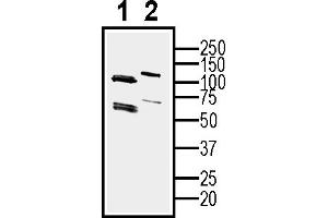 Western blot analysis of human  MG glioblastoma cell line lysate (lane 1) and  MG-derived purified exosomes (lane 2)50 μg of cells and purified exosomes lysates were analyzed using Anti-CD81 (extracellular) Antibody (ABIN7581847), (1:400). (CD81 Antikörper  (Extracellular))