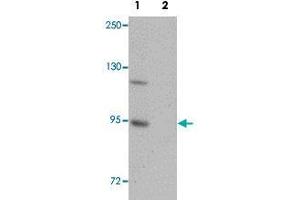 Western blot analysis of mouse brain tissue with ZC3H12B polyclonal antibody  at 1 ug/mL in (Lane 1) the absence and (Lane 2) the presence of blocking peptide .
