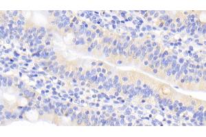 Immunohistochemistry (IHC) image for anti-Urocortin 2 (UCN2) (AA 20-112) antibody (ABIN7435022)