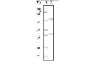 Western Blotting (WB) image for anti-Estrogen Receptor 1 (ESR1) antibody (ABIN1107144) (Estrogen Receptor alpha Antikörper)