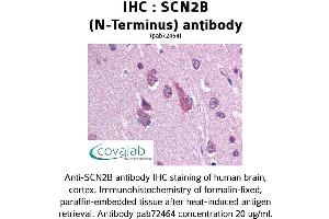 Image no. 1 for anti-Sodium Channel, Voltage-Gated, Type II, beta (SCN2B) antibody (ABIN1739059)