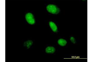 Immunofluorescence of purified MaxPab antibody to CXorf43 on HeLa cell. (HDX Antikörper  (AA 1-690))