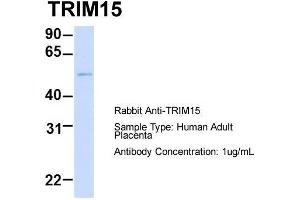 Host: Rabbit  Target Name: TRIM15  Sample Tissue: Human Adult Placenta  Antibody Dilution: 1. (TRIM15 Antikörper  (Middle Region))