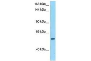 Image no. 1 for anti-phosphodiesterase 6B, CGMP-Specific, Rod, beta (PDE6B) (AA 105-154) antibody (ABIN6748131) (PDE6B Antikörper  (AA 105-154))