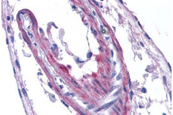 Apelin Receptor Antikörper  (Extracellular Domain)