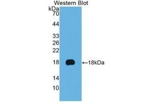 Detection of Recombinant KRT19, Human using Monoclonal Antibody to Cytokeratin 19 (CK19) (Cytokeratin 19 Antikörper  (AA 245-391))