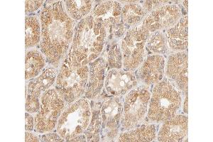 ABIN6267650 at 1/200 staining human kidney tissue sections by IHC-P. (STAT4 Antikörper  (pTyr693))