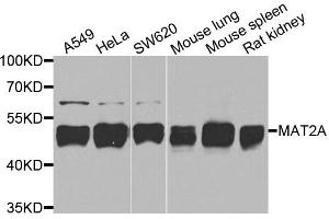 Western blot analysis of extracts of various cells, using MAT2A antibody. (MAT2A Antikörper)