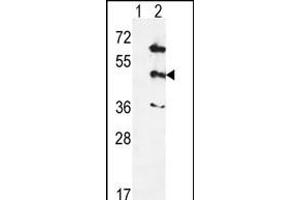 Western blot analysis of PK12 (arrow) using rabbit polyclonal hPK12- (ABIN391329 and ABIN2841359). (MAPK12 Antikörper  (AA 339-367))