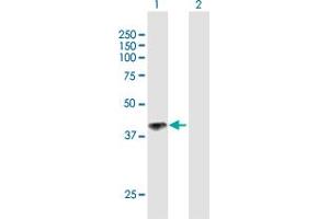 Western Blot analysis of IL12RB1 expression in transfected 293T cell line by IL12RB1 MaxPab polyclonal antibody. (IL12RB1 Antikörper  (AA 1-381))