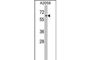Western Blotting (WB) image for anti-Resistance To Inhibitors of Cholinesterase 8 Homolog A (C. Elegans) (RIC8A) (AA 244-272) antibody (ABIN1538170)