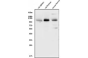 Western blot analysis of SELPLG using anti-SELPLG antibody (ABIN7600341). (SELPLG Antikörper  (AA 18-420))