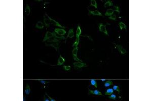 Immunofluorescence analysis of U2OS cells using MVP Polyclonal Antibody at dilution of 1:100. (MVP Antikörper)