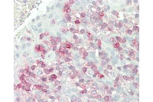 Immunohistochemistry (Paraffin-embedded Sections) (IHC (p)) image for anti-FK506 Binding Protein 10, 65 KDa (FKBP10) (AA 552-580), (C-Term) antibody (ABIN391573)