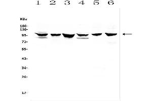 Western blot analysis of DDR1 using anti-DDR1 antibody (ABIN7601407). (DDR1 Antikörper  (AA 341-909))