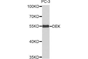 Western blot analysis of extracts of PC3 cell lines, using DEK antibody. (DEK Antikörper)