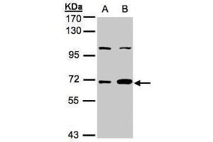 WB Image Sample(30 ug whole cell lysate) A:A431, B:MOLT4 , 7. (GBP1 Antikörper  (Internal Region))