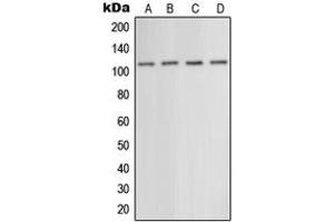 Western blot analysis of mGLUR5 expression in EOC20 (A), mouse liver (B), rat liver (C), rat brain (D) whole cell lysates.