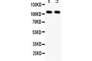 Western Blotting (WB) image for anti-Nuclear Factor of kappa Light Polypeptide Gene Enhancer in B-Cells 1 (NFKB1) (AA 193-208), (N-Term) antibody (ABIN5518703)