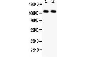 Anti- NFkB p105/p50 antibody, Western blottingAll lanes: Anti NFkB p105/p50 at 0. (NFKB1 Antikörper  (N-Term))
