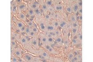 Used in DAB staining on fromalin fixed paraffin- embedded liver tissue (ABCG8 Antikörper  (AA 1-272))