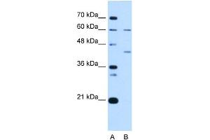 WB Suggested Anti-RFC5 Antibody Titration:  1 ug/ml  Positive Control:  Jurkat cell lysate RFC5 is strongly supported by BioGPS gene expression data to be expressed in Human Jurkat cells