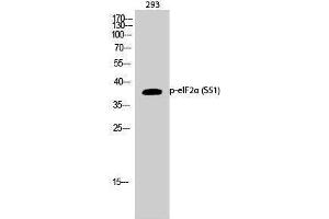 Western Blotting (WB) image for anti-Eukaryotic Translation Initiation Factor 2A, 65kDa (EIF2A) (pSer51) antibody (ABIN3172886) (EIF2A Antikörper  (pSer51))