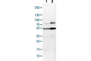 Western Blot (Cell lysate) analysis with MAPKAPK5 polyclonal antibody  Lane 1: NIH-3T3 cell lysate (Mouse embryonic fibroblast cells) Lane 2: NBT-II cell lysate (Rat Wistar bladder tumour cells) (MAPKAP Kinase 5 Antikörper)