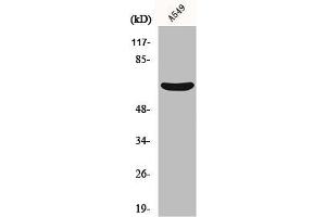 Western Blot analysis of A549 cells using MMP-11 Polyclonal Antibody (MMP11 Antikörper  (Internal Region))