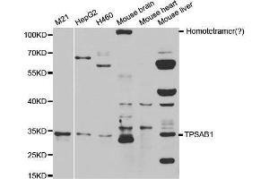 Western blot analysis of extracts of various cell lines, using TPSAB1 antibody. (TPSAB1 Antikörper  (AA 19-210))