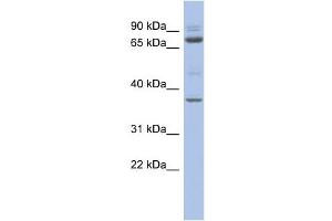 WB Suggested Anti-MTF2 Antibody Titration:  0. (MTF2 Antikörper  (Middle Region))